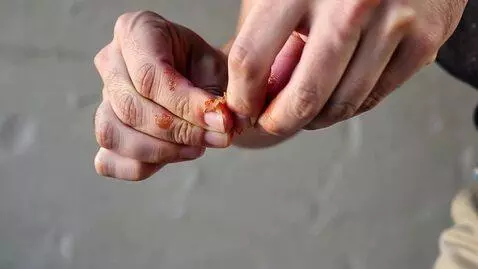 Kling 1.6 (pro) video