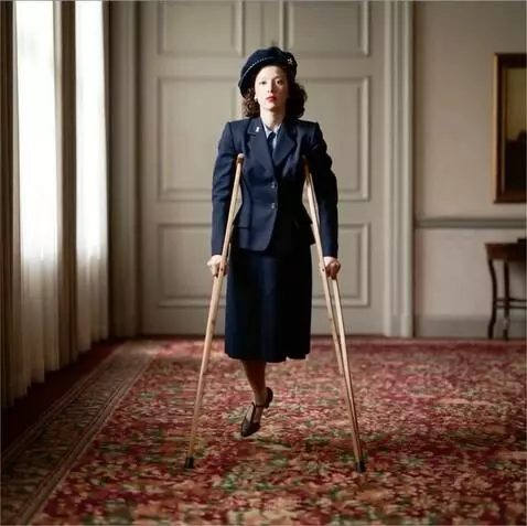 AI Video from prompt: A woman with the left leg amputated up to the up