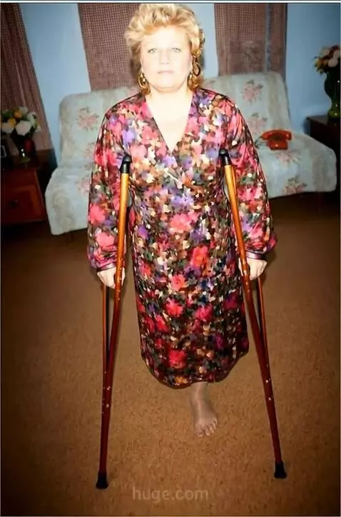 AI Video from prompt: A woman with the right leg amputated up to the u