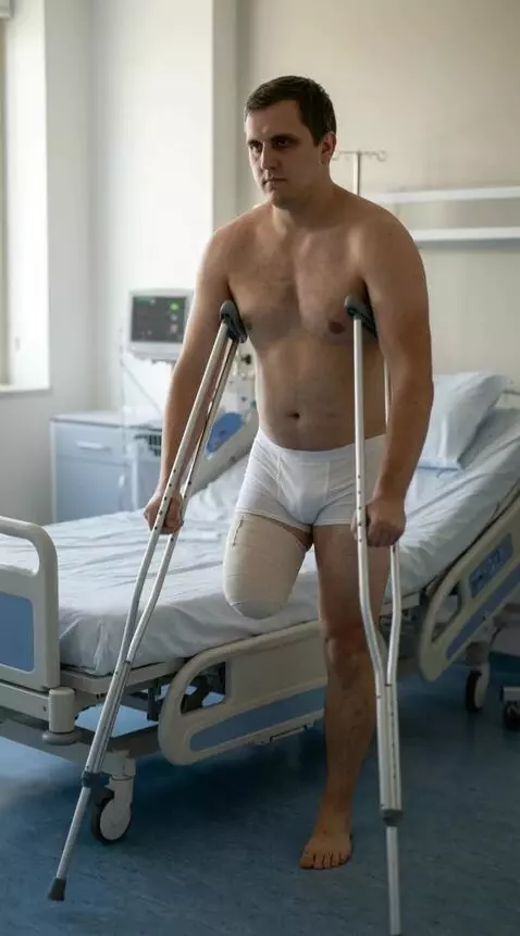 AI Video from prompt: A man with the right leg amputated up to the upp