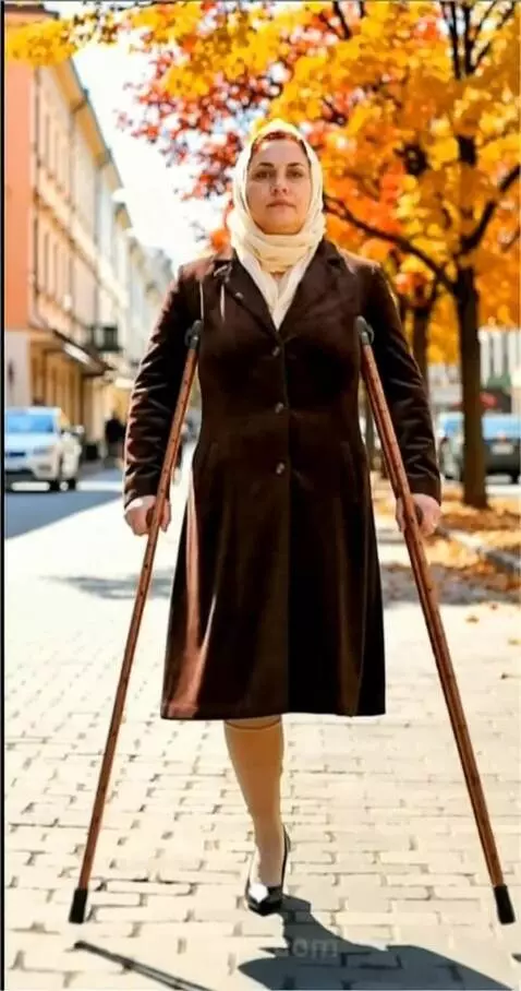 AI Video from prompt: A woman with the left leg amputated up to the lo