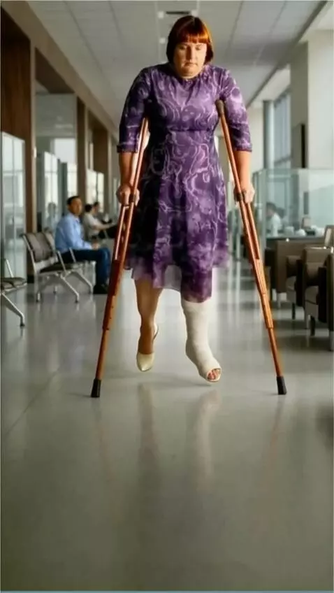 AI Video from prompt: A woman with the broken left leg walks slowly to