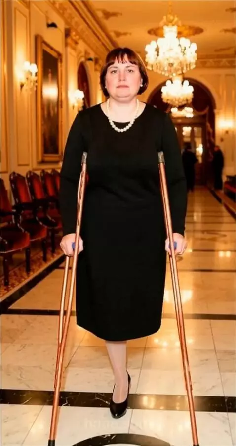 AI Video from prompt: A woman with the left leg amputated up to the lo