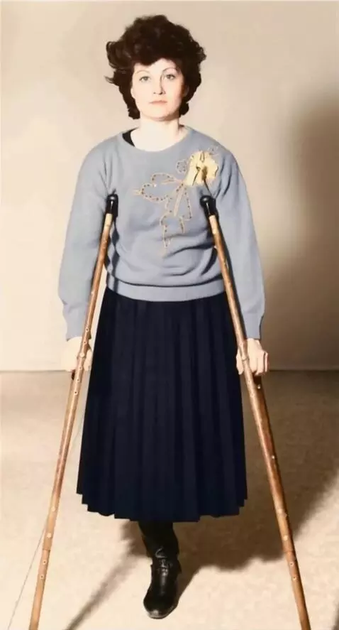 AI Video from prompt: A woman with the left leg amputated up to the up