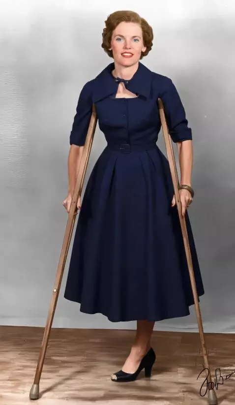 AI Video from prompt: A woman with the right leg amputated up to the u