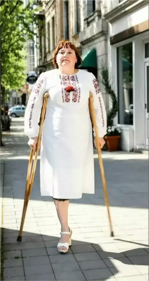 AI Video from prompt: Kling 2.5 Turbo (pro) A woman with the left leg 