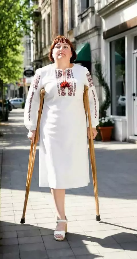 AI Video from prompt: A woman with the left leg amputated up to the lo