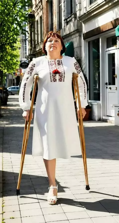 AI Video from prompt: A woman with the left leg amputated up to the lo