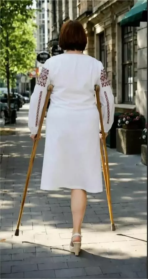 AI Video from prompt: A woman with the left leg amputated up to the lo