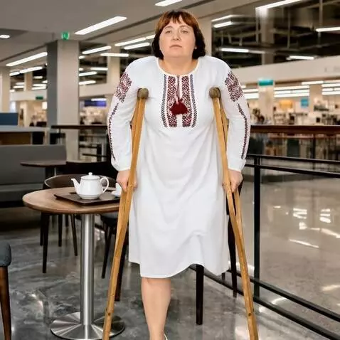 AI Video from prompt: A woman with the left leg amputated up to the lo