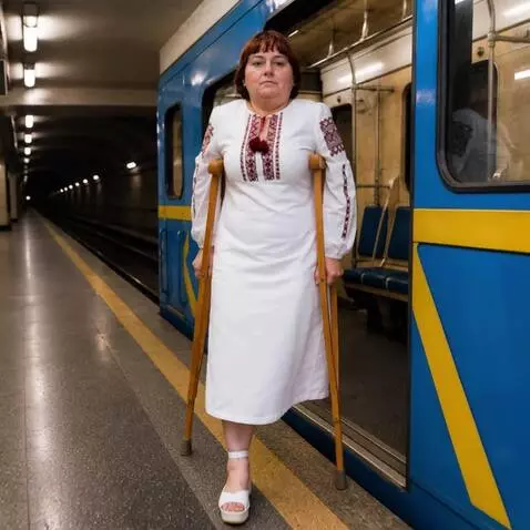 AI Video from prompt: The woman with the left leg amputated up to the 
