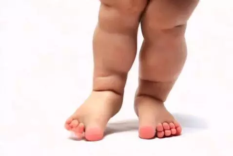 AI Video from prompt: little girl showing her feet
