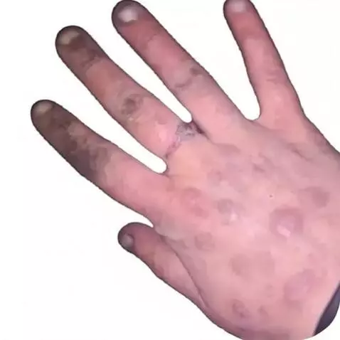 AI Video from prompt: hand moving it fingers