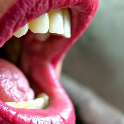 LTX Video-0.9.8 13B Distilled video