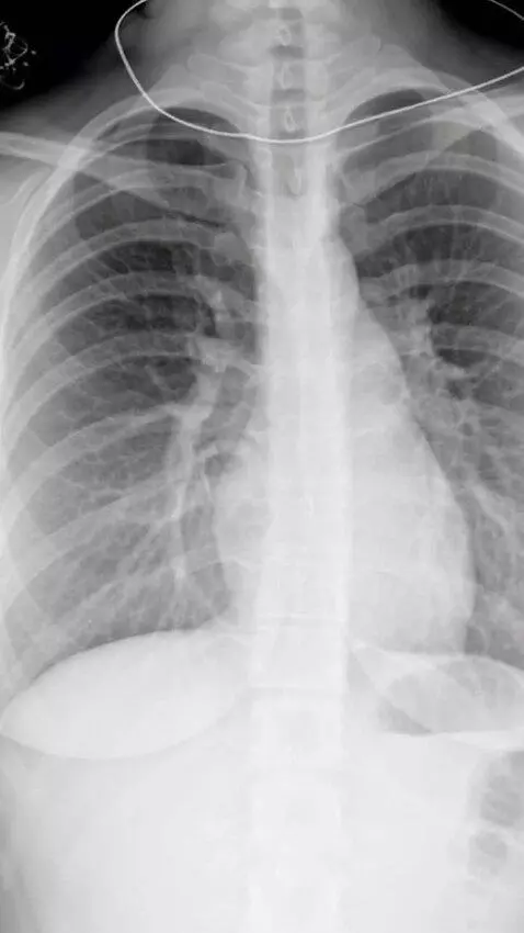 AI Video from prompt: Create a hyper-realistic image of a human torso 