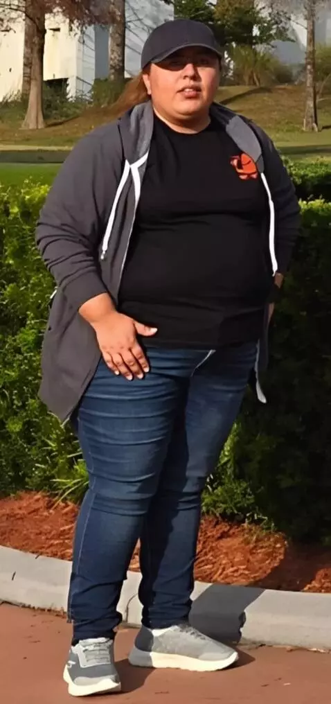 AI Video from prompt: The woman lifts up her shirt and shows her stoma