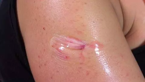 Kling 1.0 (standard) video