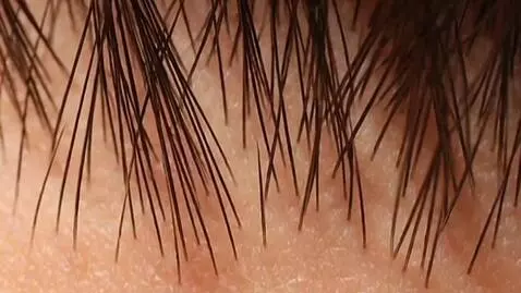 AI Video from prompt: Videos with changing images of the liver, kidney