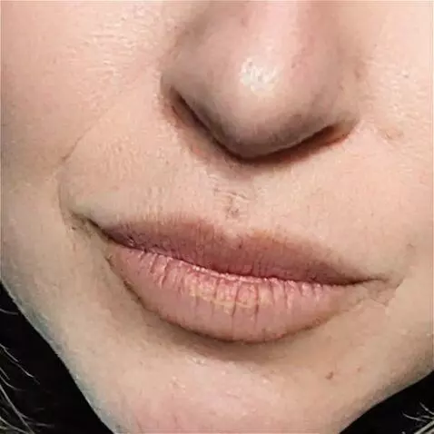 AI Video from prompt: the camera zooms in on the lips