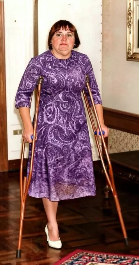 AI Video from prompt: The camera shoots a one-legged woman on crutches