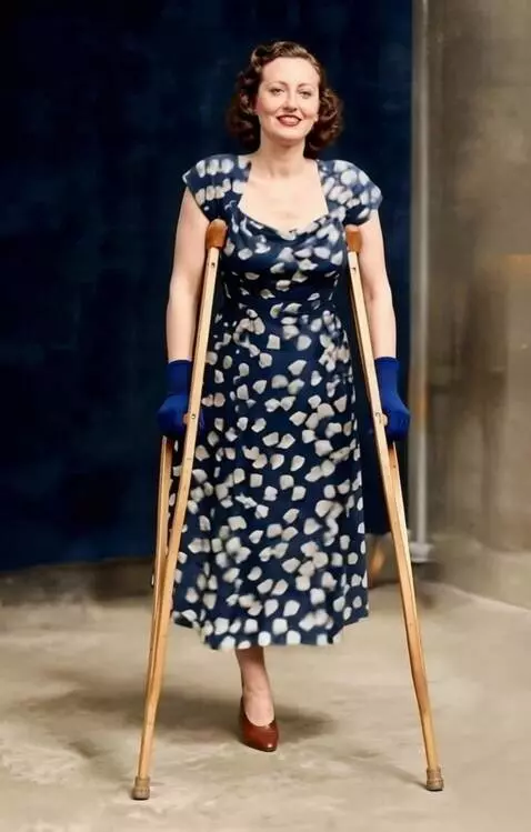 AI Video from prompt: The camera shoots a one-legged woman on crutches