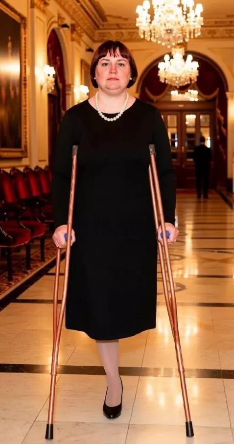AI Video from prompt: A one-legged woman walks slowly toward the camer