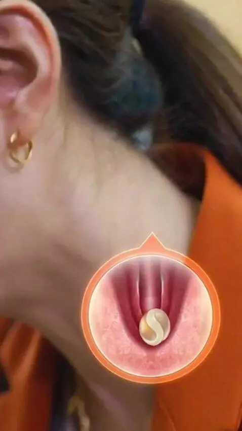 AI Video from prompt: Strepsils Chesty Cough – 15-second Advertisement