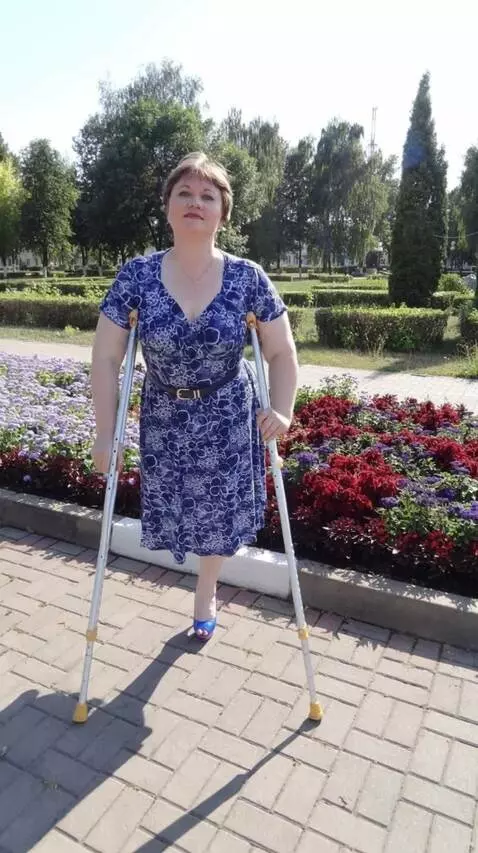 AI Video from prompt: A one-legged woman walks unhurriedly toward the 