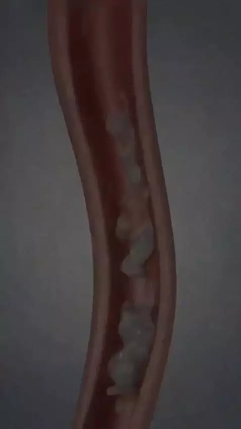 AI Video from prompt: Strepsils Chesty Cough Advertisement – 4 Seconds