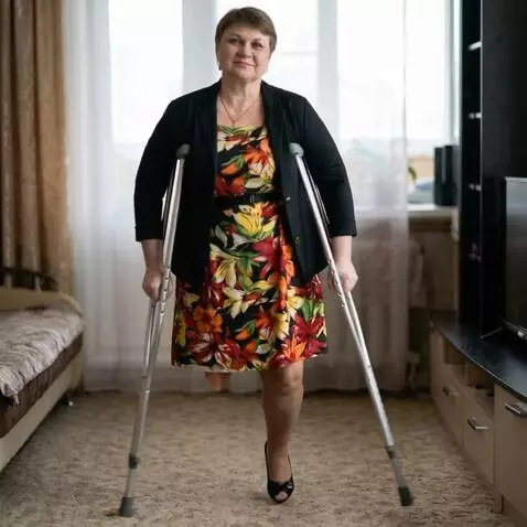AI Video from prompt: A one-legged woman walks unhurriedly toward the 