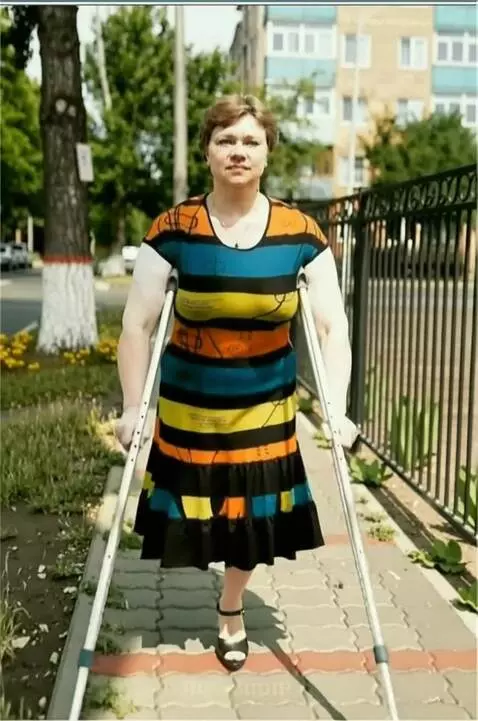 AI Video from prompt: A one-legged woman walks dynamically toward the 