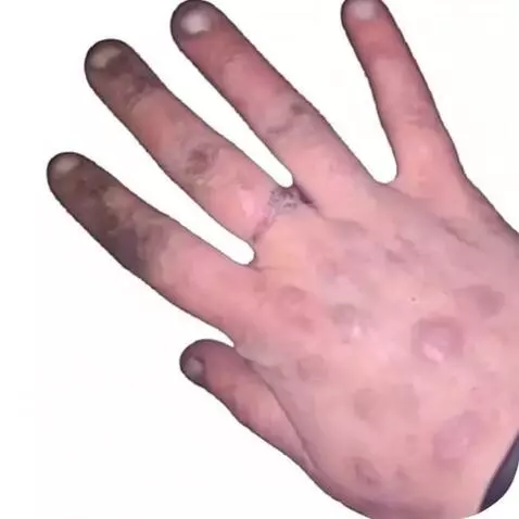 make persons hand moving fingers by janne