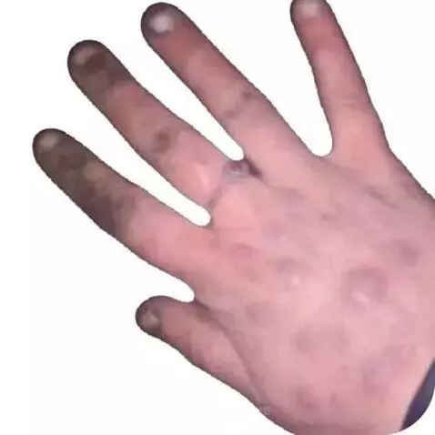 video poster