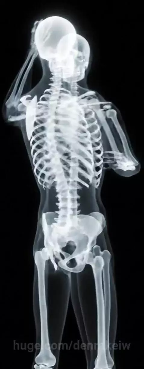 X-Ray by denrakeiw