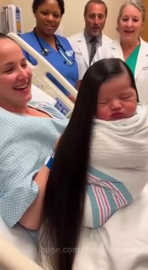 Never seen a baby with this hair length by daniel