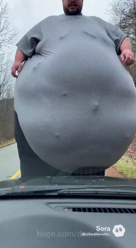Morbidly obese man with a giant, distended belly that appears to touch the asphalt while standing on a rural road.