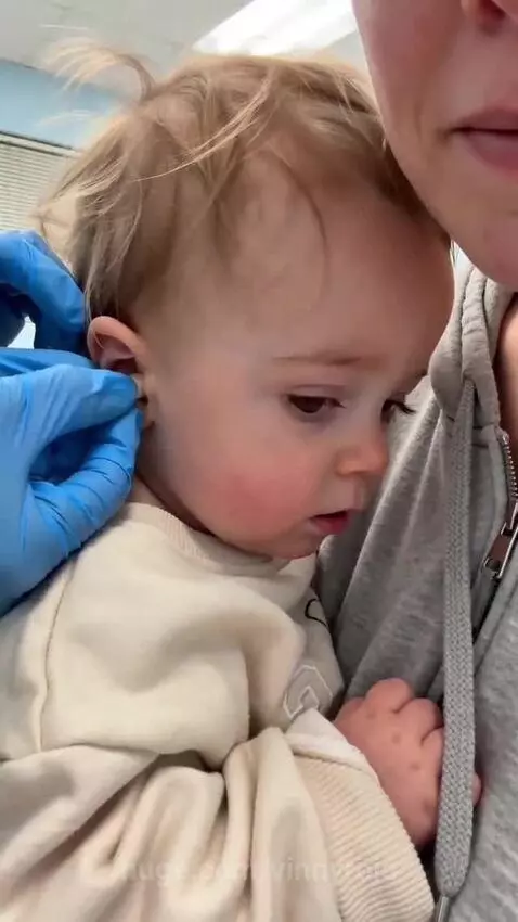 Baby wearing hearing aids smiles joyfully after hearing a sound for the first time.