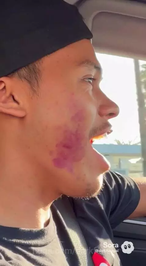 Man with a purple cheek bruise in a car, woman driving, pointing to a red button on the dashboard.