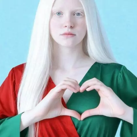 Woman with albinism, platinum blonde hair, wearing a red and green wrap dress, posing against a blue background.